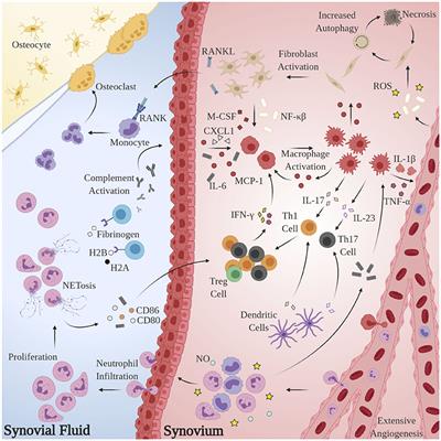 The Role of Chronic Inflammatory Bone and Joint Disorders in the Pathogenesis and Progression of Alzheimer's Disease